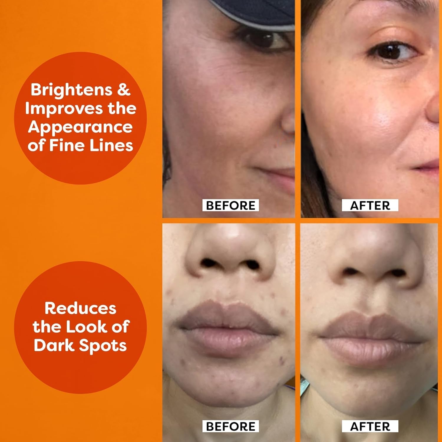 Vitamin C Serum for Face – anti Aging Formula with Vitamin C, Hyaluronic Acid, Vitamin E – Brightening Serum – Improve Appearance of Dark Spots, Tone, Fine Lines & Wrinkles, 1 Fl Oz